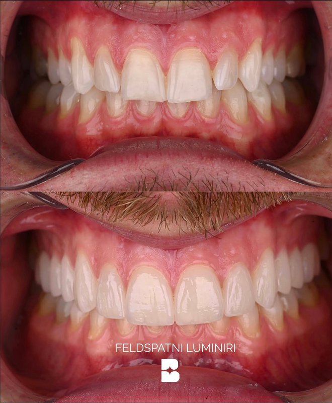 Stomatološka ordinacija Brilliant Smile – slika 3