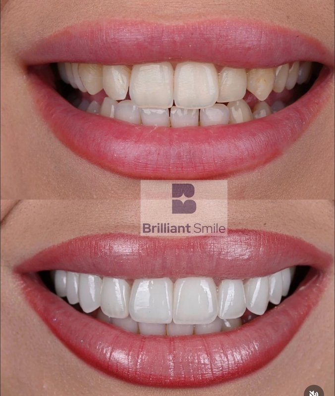 Stomatološka ordinacija Brilliant Smile – slika 2